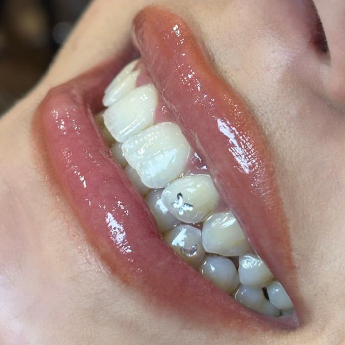 joya-dental-esencia-estetica-montilla