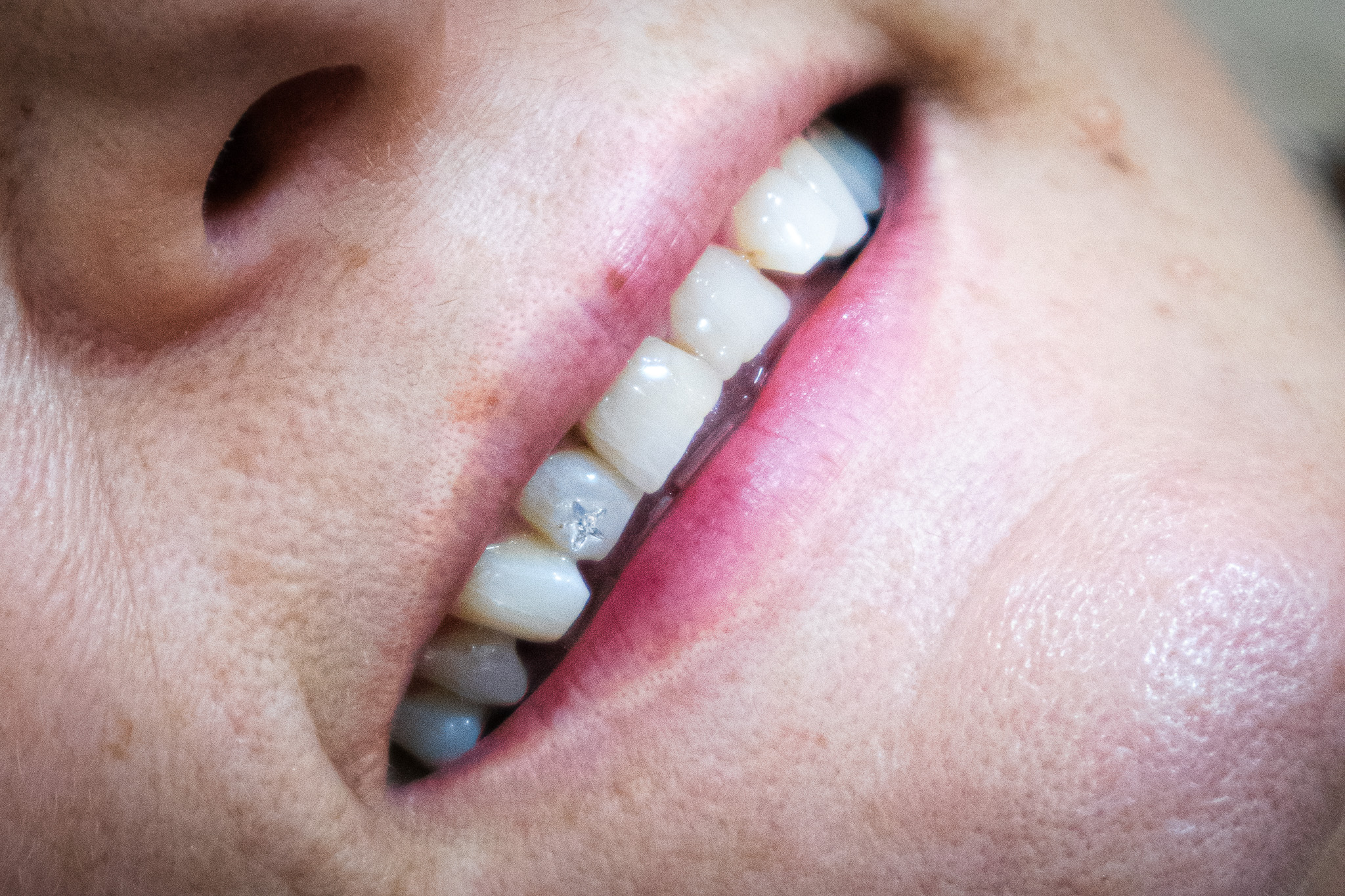 joyas-dentales-esencia-estetica-montilla-raquel-de-la-torre joyas-dentales-esencia-estetica-montilla-raquel-de-la-torre