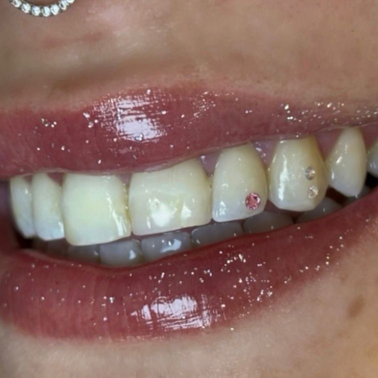 joyas-dentales-esencia-estetica-montilla-raquel-de-la-torre joyas-dentales-esencia-estetica-montilla-raquel-de-la-torre